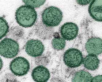 Hantavirus : l’OMS écarte le scénario d’un « nouveau Covid-19 »